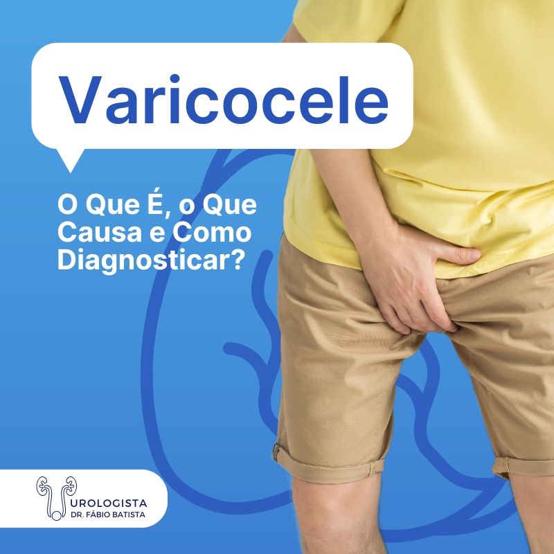 varicocele